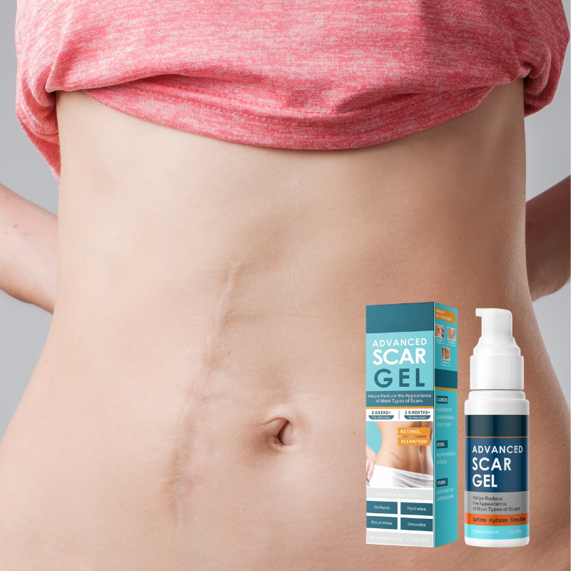 Gel Réparateur Anti-Cicatrices ScarFix™