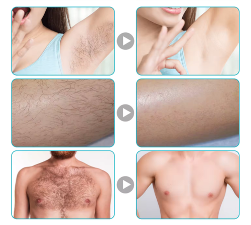 CRÈME DÉPILATOIRE MAGIC – PEAU LISSE SANS DOULEUR