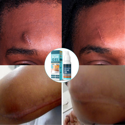 Gel Réparateur Anti-Cicatrices ScarFix™