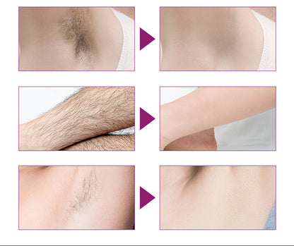 SPRAY DÉPILATOIRE RAPIDE – PEAU LISSE SANS DOULEUR